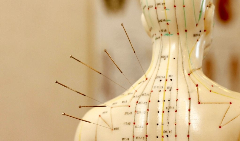 Châm cứu chữa đau vai gáy có tác dụng gì, có thật sự hiệu quả không? 2