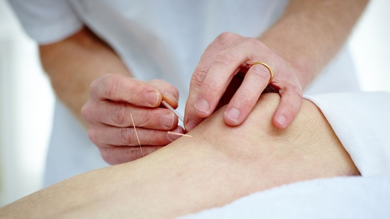 Châm cứu chữa viêm khớp có hiệu quả không? Cách thực hiện 1