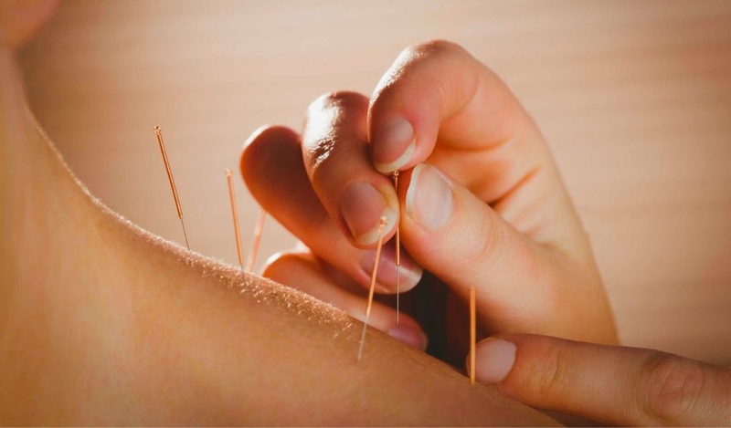 Châm cứu thoái hóa đốt sống cổ có hiệu quả không? Cần lưu ý những gì? 2