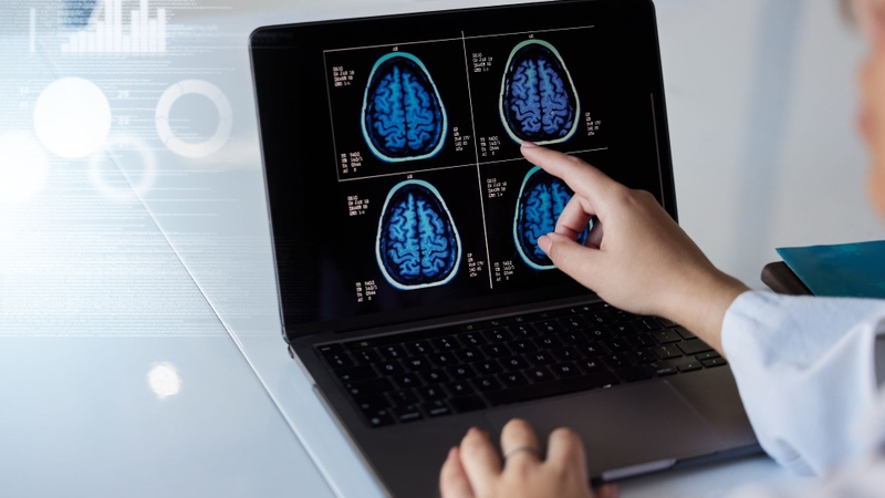 Chăm sóc bệnh nhân sau mổ u tuyến yên như thế nào? 1