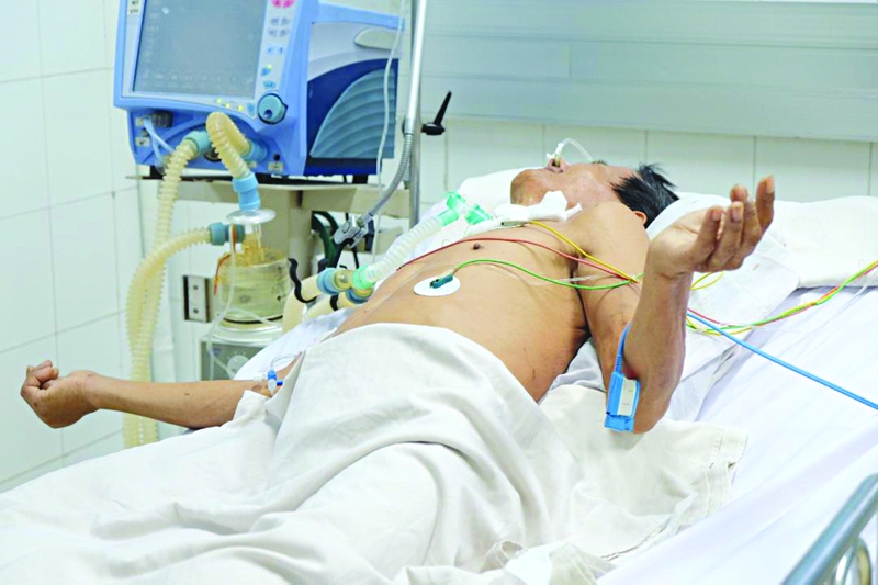 Chăm sóc bệnh nhân uốn ván sao cho mau khỏi 1