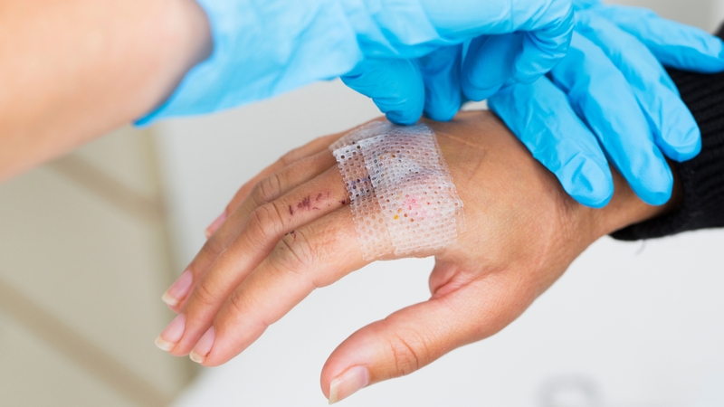 Chăm sóc bệnh nhân uốn ván sao cho mau khỏi 2