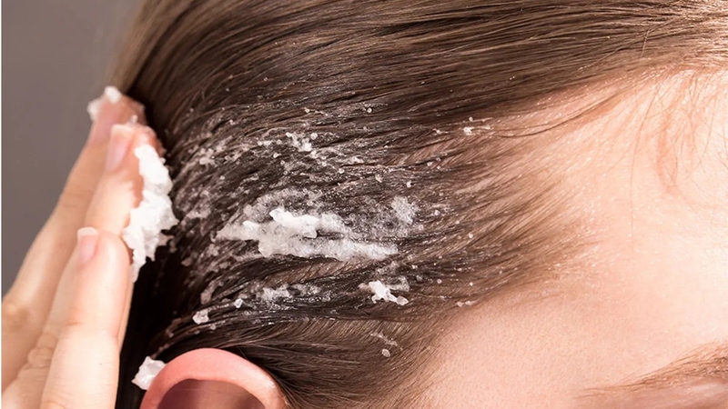 Các loại da đầu và cách chăm sóc da đầu theo từng loại 3