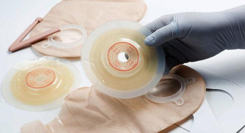 Chăm sóc hậu môn nhân tạo đúng cách, bạn đã biết chưa? 4