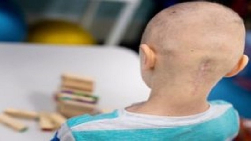 chăm sóc và theo dõi sau khi điều trị bệnh u lympho không Hodgkin ở trẻ em 2