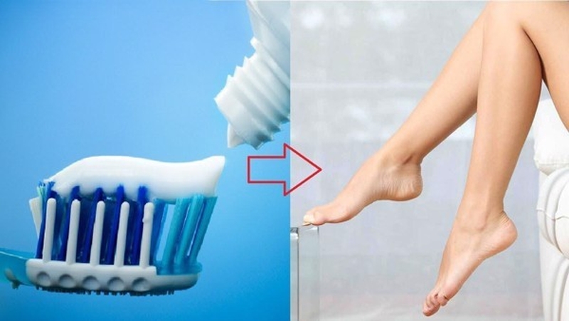 3 Cách trị nứt gót chân tại nhà đơn giản, hiệu quả 1