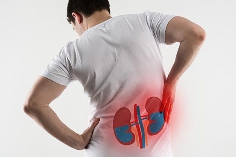 Chẩn đoán phân độ thận ứ nước trên siêu âm1