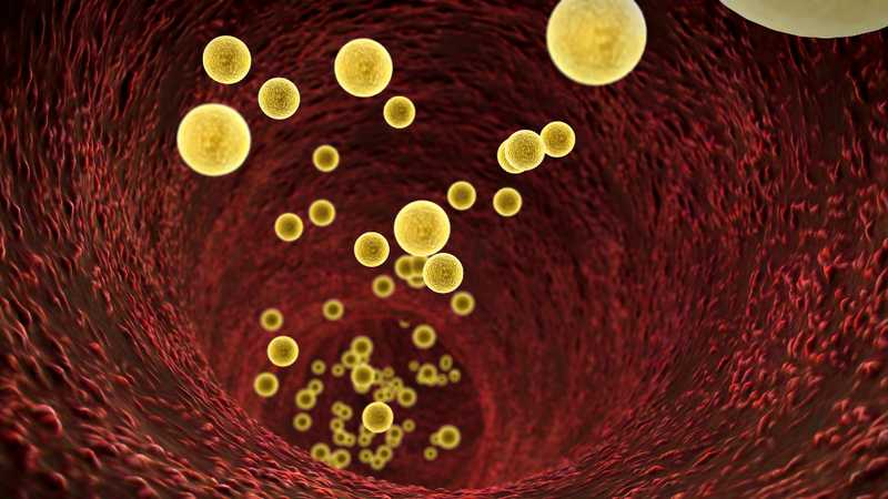 chan-doan-roi-loan-lipid-mau-nhu-the-nao 1
