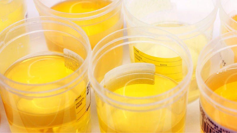 chan-doan-suy-than-cap 1