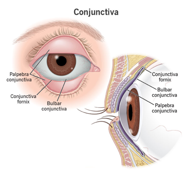 Chẩn đoán u kết mạc qua sinh thiết tổ chức kết mạc 2