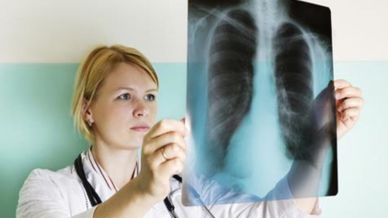 Chẩn đoán ung thư phổi bằng phương pháp nào? 2