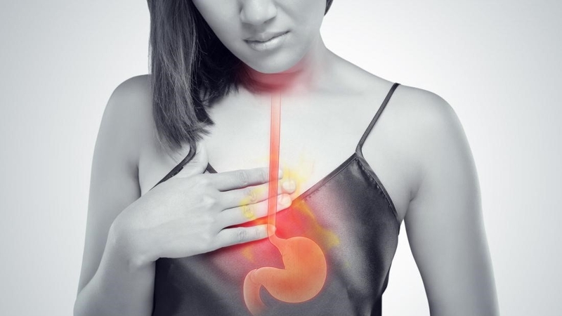 Ợ nóng có thể là triệu chứng barrett thực quản