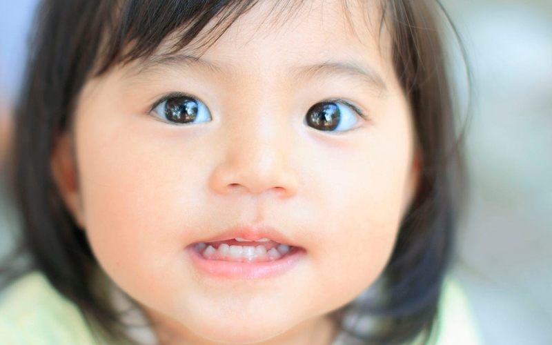 Chẩn đoán và điều trị lé trong bẩm sinh 1