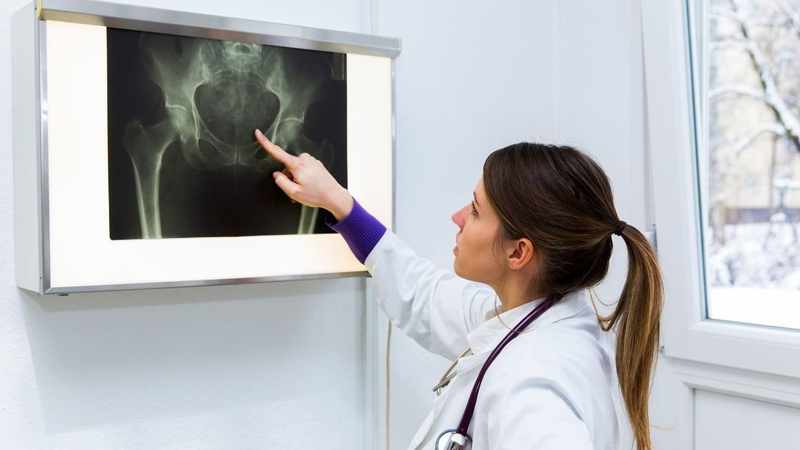 Chẩn đoán và điều trị viêm cột sống dính khớp như thế nào?