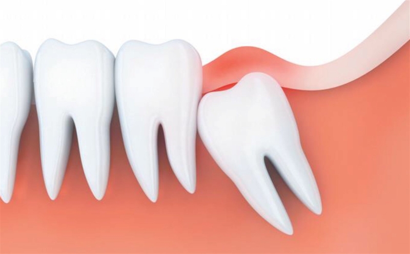 chan-rang-la-gi-chan-rang-co-cau-tao-va-chuc-nang-nhu-the-nao 1.jpg