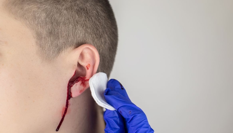 Chấn thương tai ngoài​: Nguyên nhân, triệu chứng và cách điều trị 3