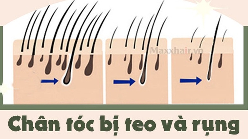 Chân tóc bị teo và rụng: dấu hiệu, nguyên nhân và phương pháp điều trị 1