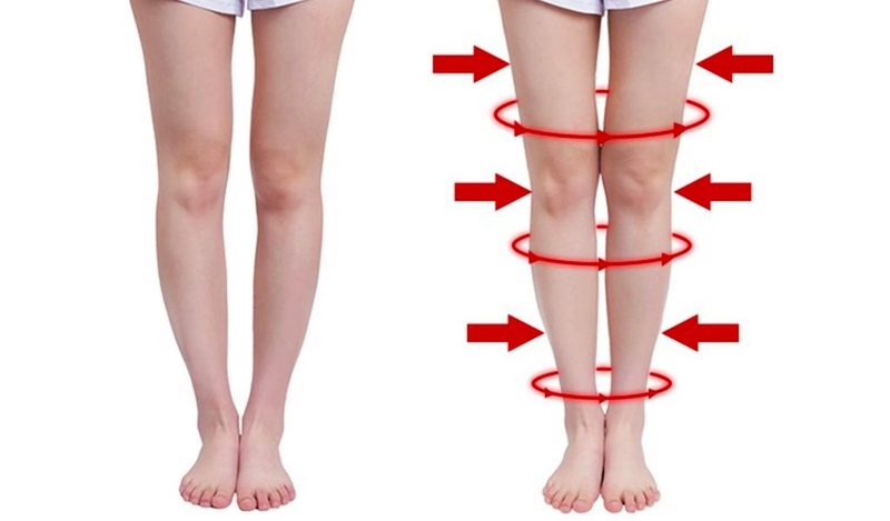 Chân vòng kiềng có ảnh hưởng đến chiều cao không? 1