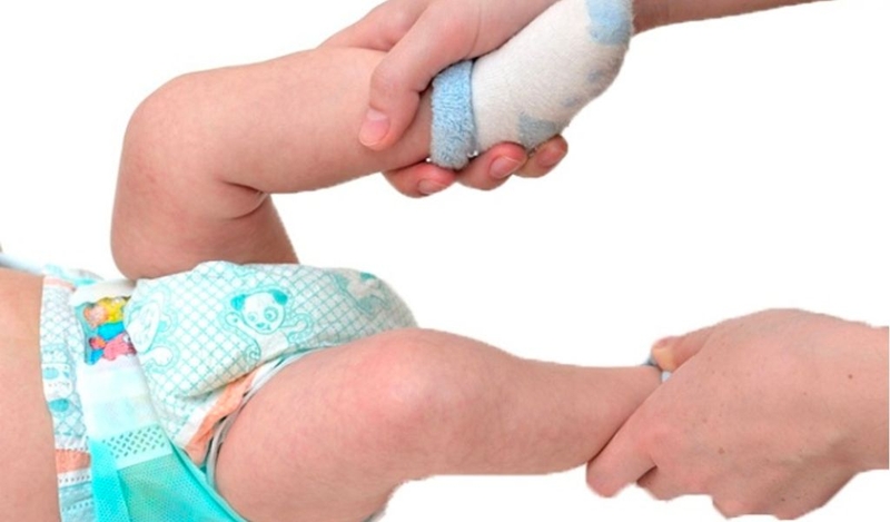 Chân vòng kiềng có chữa được không? Cách khắc phục? 1