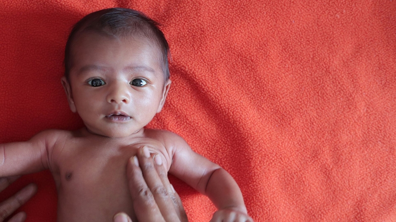 Chân vòng kiềng: Nguyên nhân, dấu hiệu và cách khắc phục 1