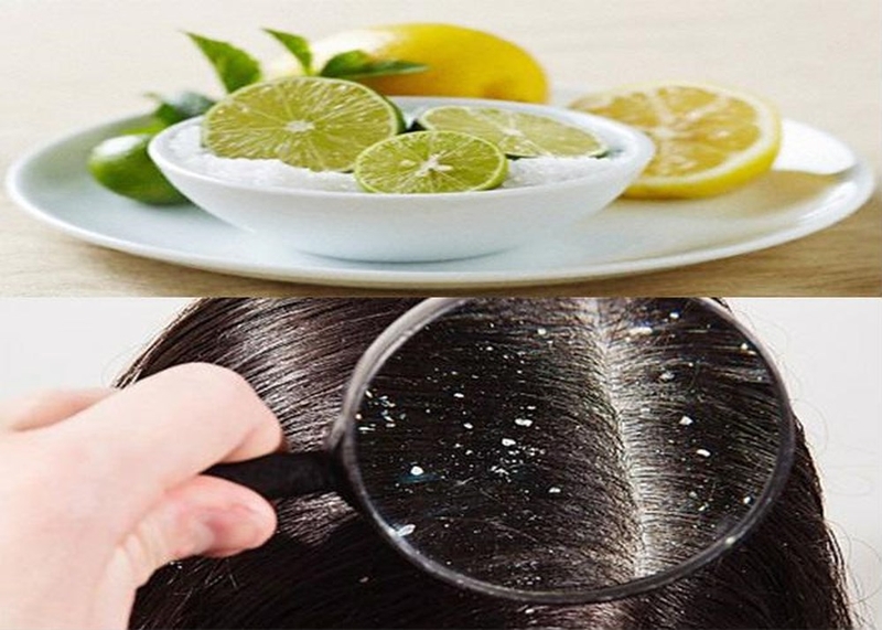 ​  Axit citric trong chanh có thể gây kích ứng da đầu 3 ​