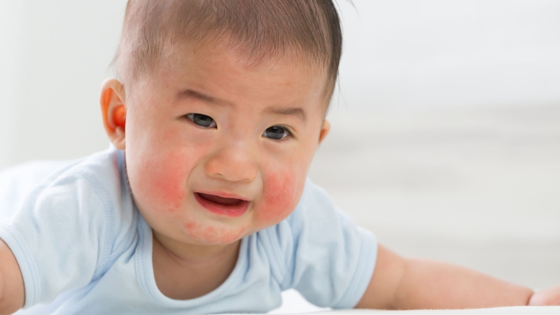 Nếu bé có dấu hiệu dị ứng, cần ngừng cho ăn và thử lượng nhỏ trước để theo dõi phản ứng trong 24 giờ