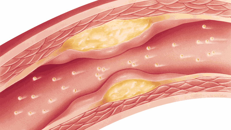 Chất béo trong cơ thể chuyển hóa thế nào khi bạn giảm cân? 1