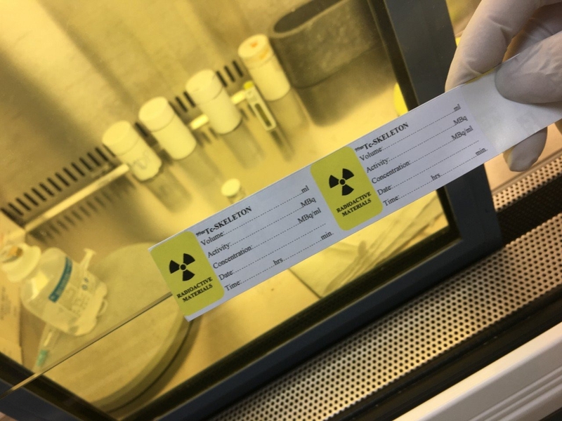 Chất phóng xạ gây ung thư khi nào? Phương pháp điều trị ung thư bằng dược chất phóng xạ 3