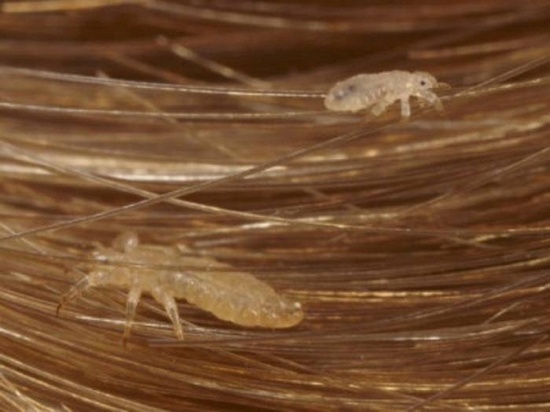 con-chay-sinh-ra-tu-dau-nguyen-nhan-va-cach-phong-ngua-2