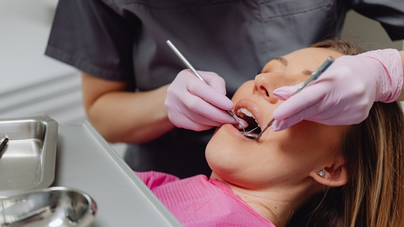 Lấy cao răng định kỳ hạn chế gây viêm nướu và chảy máu chân răng