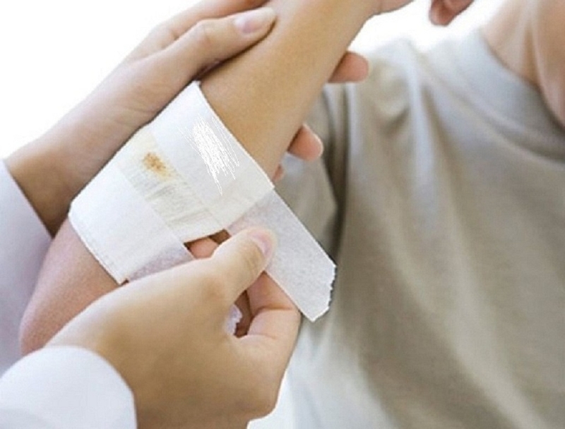 Chảy máu động mạch có đặc điểm gì? Cách sơ cứu cho nạn nhân bị chảy máu động mạch 3