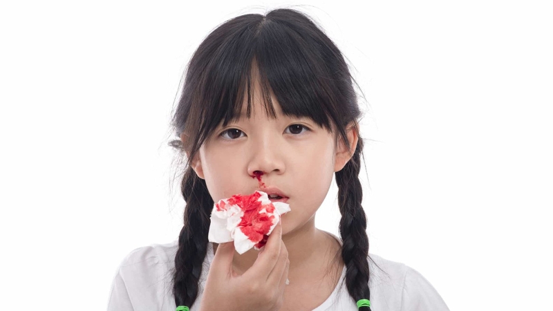 Chảy máu mũi liên tục cảnh báo bệnh gì 1
