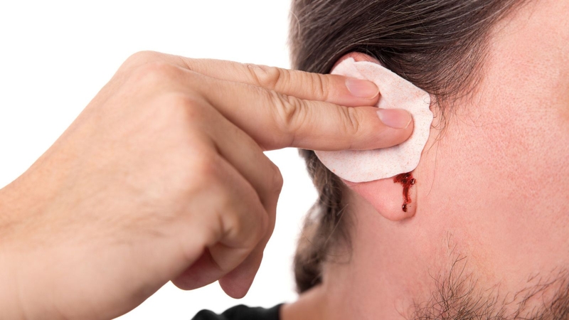 chan-thuong-so-nao-chay-mau-tai-thi-co-hau-qua-gi-1