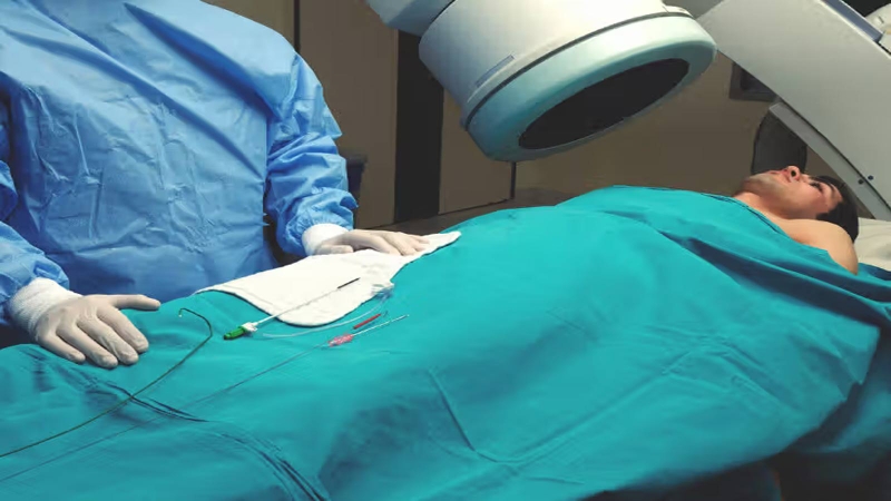 Chảy máu trong ổ bụng không do chấn thương: Chẩn đoán, điều trị 4