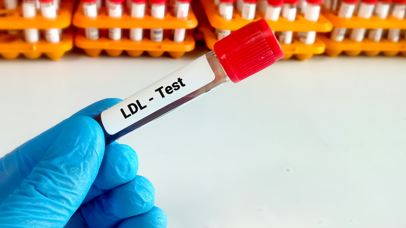 Thịt đỏ và mỡ động vật chứa nhiều chất béo bão hòa và cholesterol, khi tiêu thụ quá nhiều có thể làm tăng cholesterol xấu