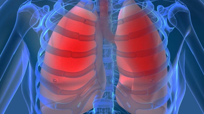 Chỉ định đặt nội khí quản: Điều kiện thực hiện và chăm sóc sau thủ thuật 1