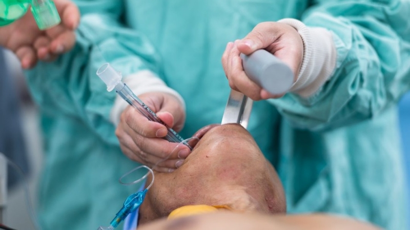 Chỉ định đặt nội khí quản: Điều kiện thực hiện và chăm sóc sau thủ thuật 3