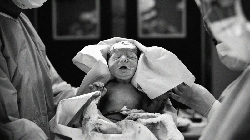 Chỉ định mổ lấy thai: 3 trường hợp bắt buộc can thiệp để giữ an toàn cho mẹ và bé 3