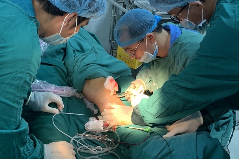 Chi phí chữa giãn tĩnh mạch bằng sóng cao tần không phải ai cũng biết 3