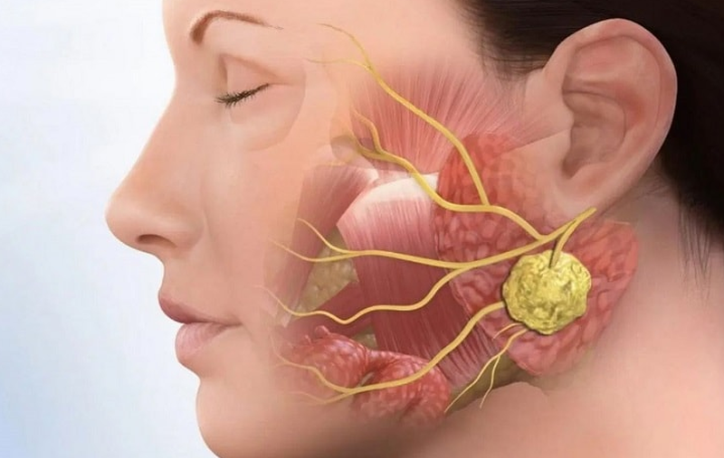 Chi phí điều trị viêm khớp thái dương hàm từ giai đoạn nhẹ đến nặng 1