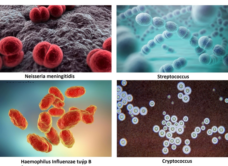 chi phí điều trị viêm màng não 1