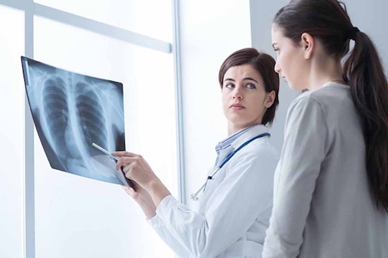 Chi phí hóa trị ung thư phổi có tốn kém không?