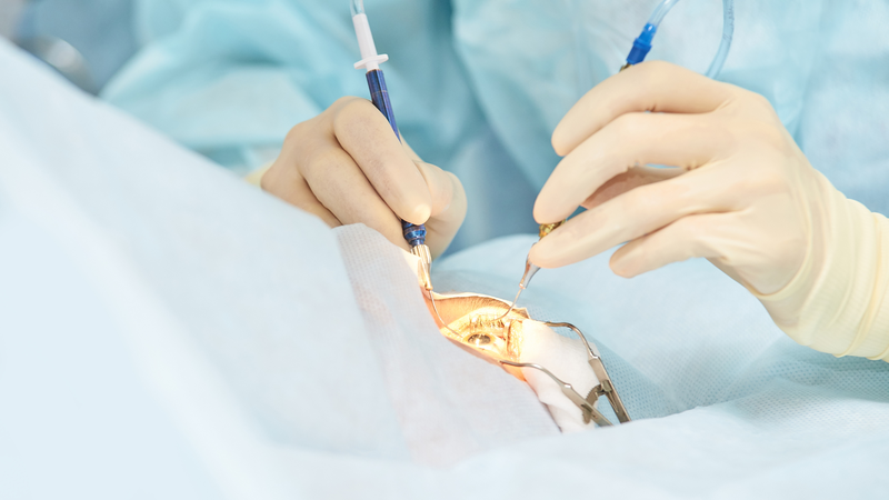 Chi phí mổ bong võng mạc phụ thuộc vào rất nhiều yếu tố khác nhau
