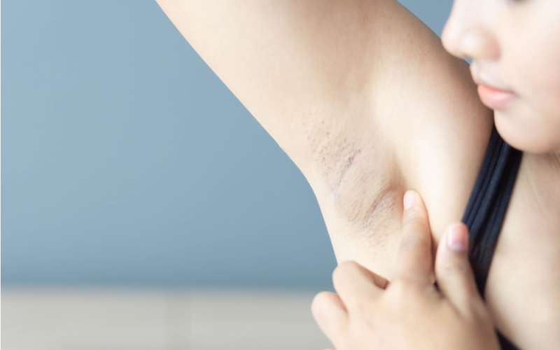 chi-phi-mo-hach-o-nach-co-mac-khong-khi-nao-can-mo-hach-o-nach 1