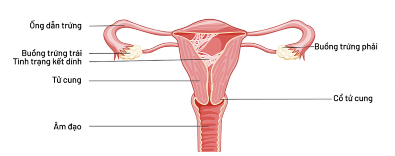 tham-khao-chi-phi-phau-thuat-dinh-buong-tu-cung-o-cac-benh-vien 1
