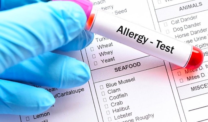 Chi phí xét nghiệm dị ứng đạm sữa bò? Cách xử lý khi trẻ dị ứng? 2