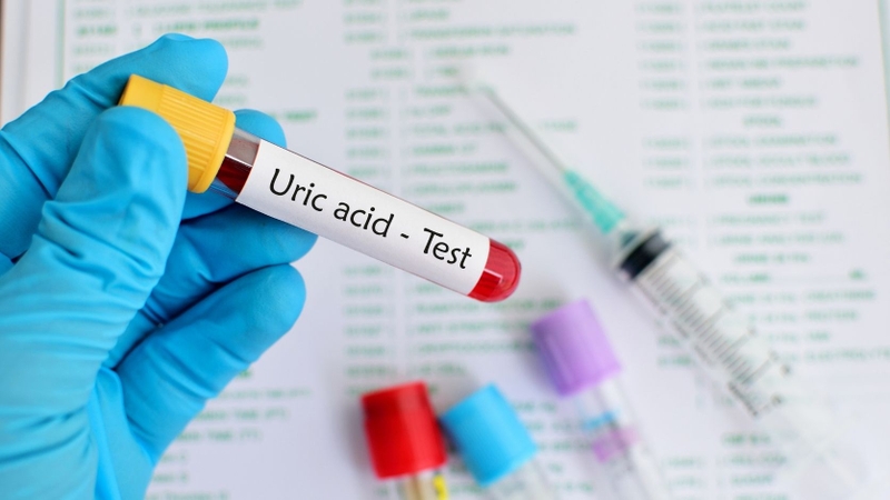 Chỉ số acid uric bao nhiêu là bình thường?