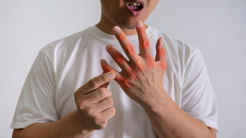 Chỉ số acid uric bao nhiêu thì bị gout? Mức cảnh báo nguy hiểm và cách phòng ngừa 2