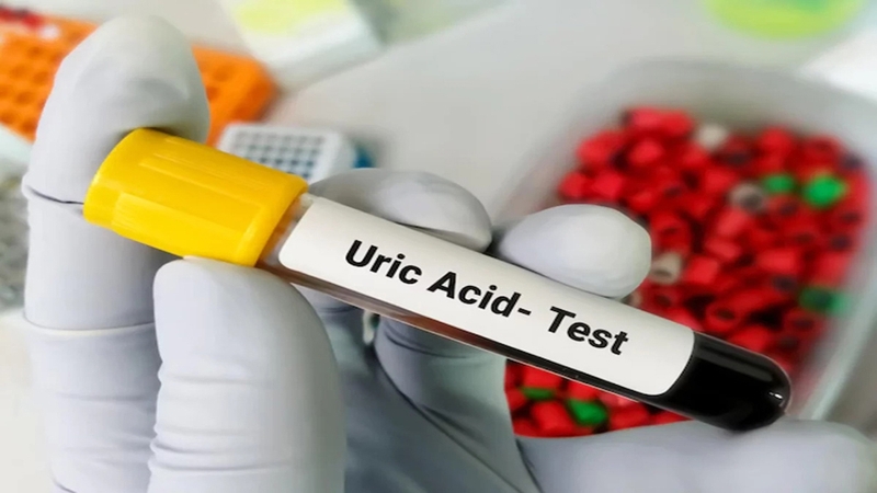 Chỉ số acid uric bình thường là bao nhiêu mới an toàn? 2