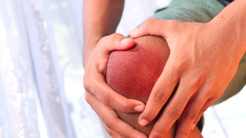 Acid uric tích tụ như thế nào?